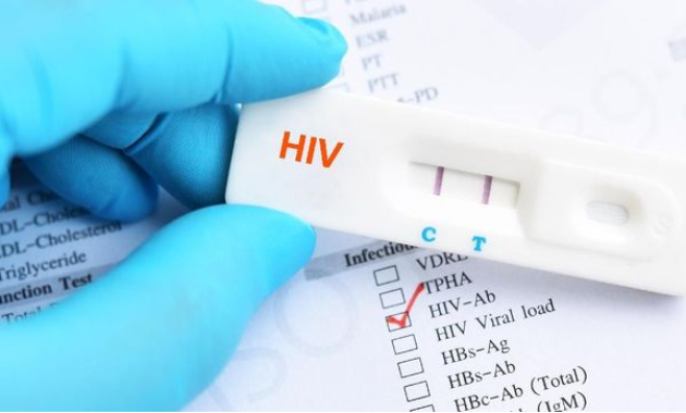 Ngeri! Tren Kasus HIV/AIDS di Brebes Selalu Meningkat, Setahun 35 Orang Meninggal