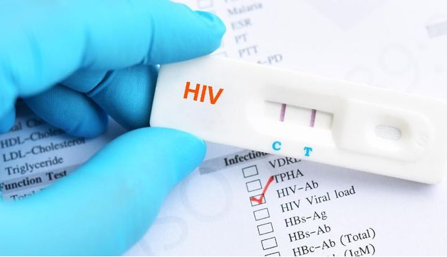 kasus hiv/aids di Brebes. aids brebes,