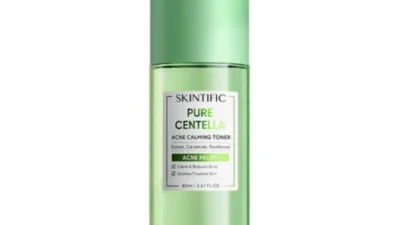 6 Toner untuk Kulit Berminyak Terbaik, Bantu Kontrol Minyak dan Cegah Jerawat